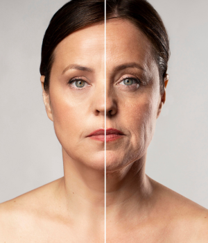 Anti velhecimento Clinica Bella Forma