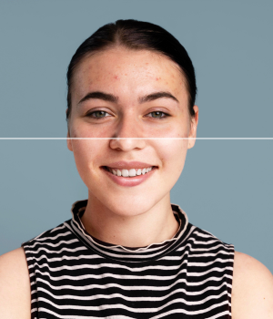 Tratamento facial Clinica estetica Bella Forma